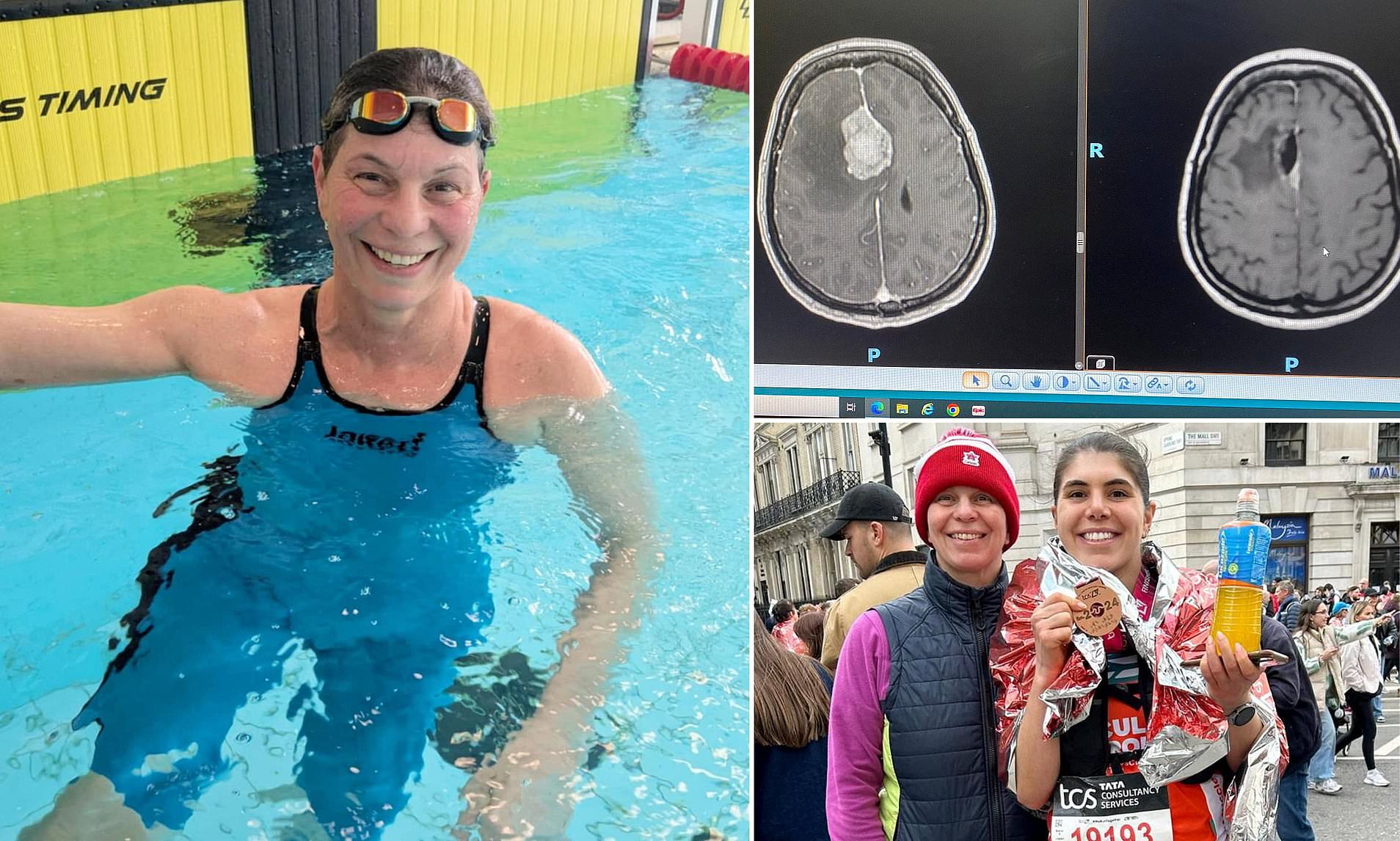 Doctors Ignored My Dizziness—It Was Actually a Hidden Tumor Warning
